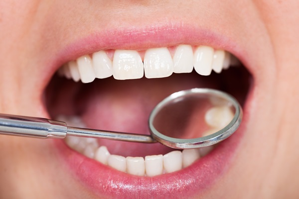 How A Dental Filling Can Treat Tooth Decay